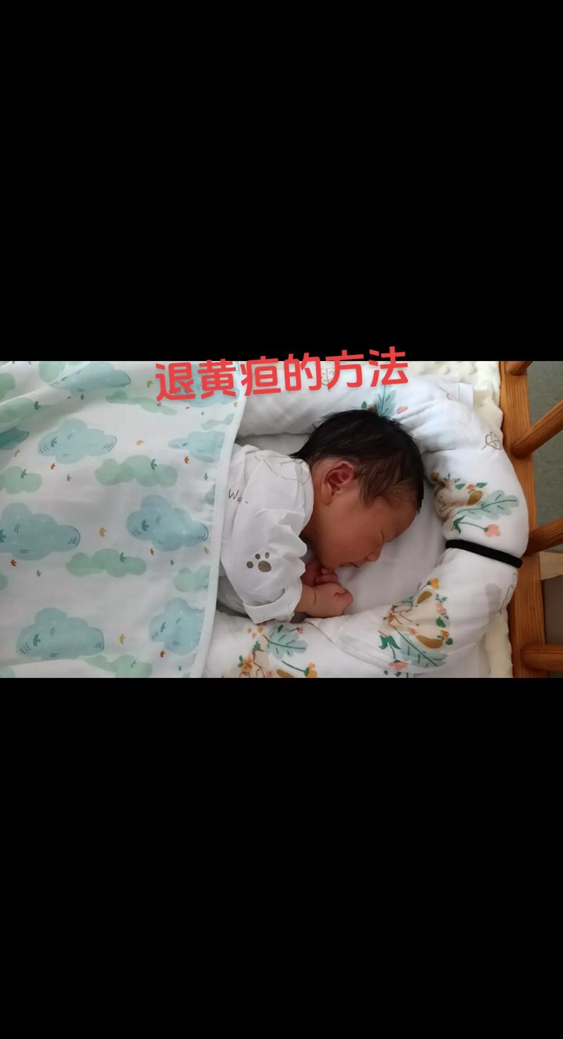 新生儿黄疸在家处理能自行判断轻重？退黄护理怎么做才安全有效？-第2张图片-郑州医学网
