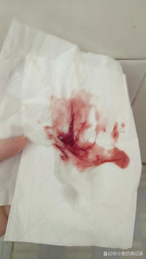 孕期宫颈糜烂出血会一直持续到分娩吗？对胎儿和分娩方式有哪些影响？-第3张图片-郑州医学网