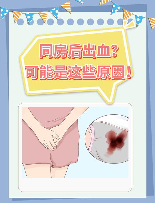 孕期宫颈糜烂出血会一直持续到分娩吗？对胎儿和分娩方式有哪些影响？-第2张图片-郑州医学网