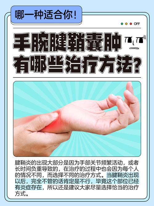 儿童腱鞘囊肿非手术能自愈吗？有哪些安全有效的治疗方法？-第2张图片-郑州医学网