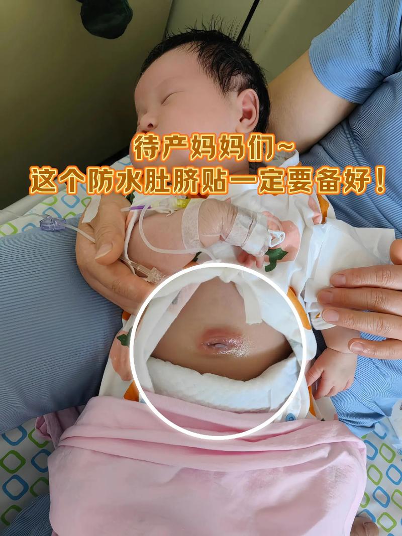 新生儿脐带出血是正常现象还是异常信号？该如何正确处理与护理？-第2张图片-郑州医学网