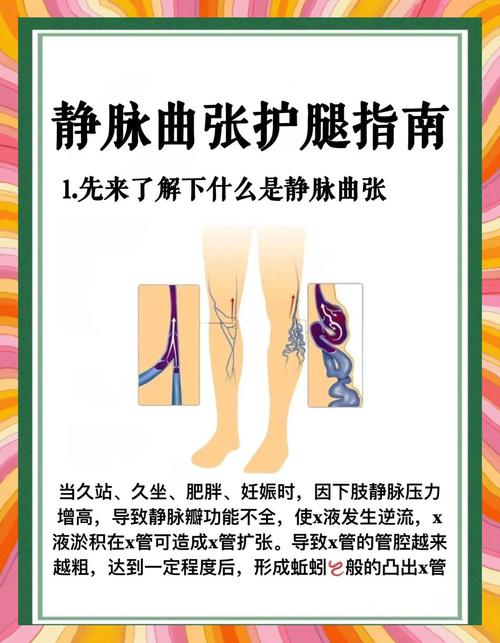 孕期如何有效预防静脉曲张?有哪些科学方法能缓解腿部不适?-第1张图片-郑州医学网 孕期如何有效预防静脉曲张?有哪些科学方法能缓解腿部不适?-第1张图片-郑州医学网