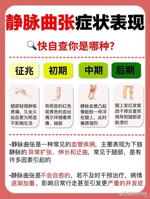 孕期如何有效预防静脉曲张?有哪些科学方法能缓解腿部不适?-第2张图片-郑州医学网 孕期如何有效预防静脉曲张?有哪些科学方法能缓解腿部不适?-第2张图片-郑州医学网