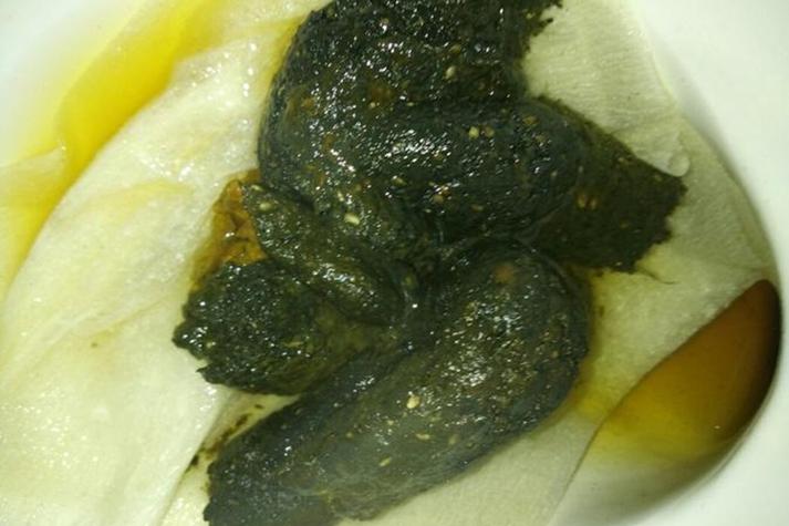 孕期服用爱乐维后大便变绿色，是正常现象还是身体异常信号？-第1张图片-郑州医学网