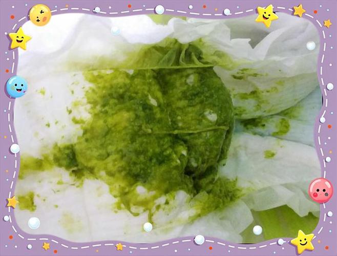 孕期服用爱乐维后大便变绿色，是正常现象还是身体异常信号？-第2张图片-郑州医学网