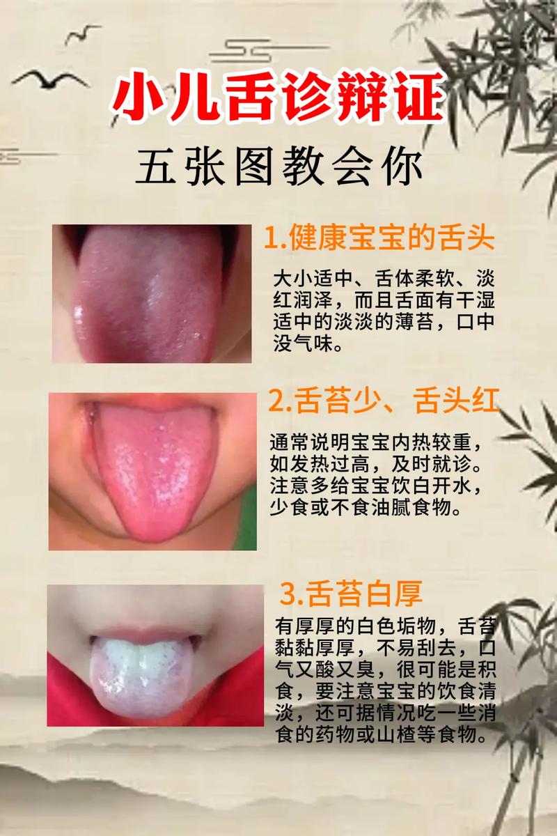 新生儿舌苔发白是正常现象还是健康预警？需要干预吗？-第1张图片-郑州医学网
