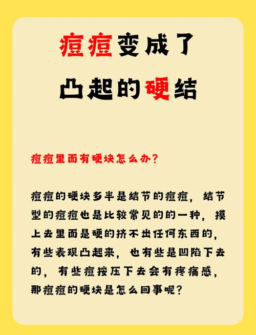 孕期脸上长痘，如何安全有效去除又不伤胎儿？-第2张图片-郑州医学网