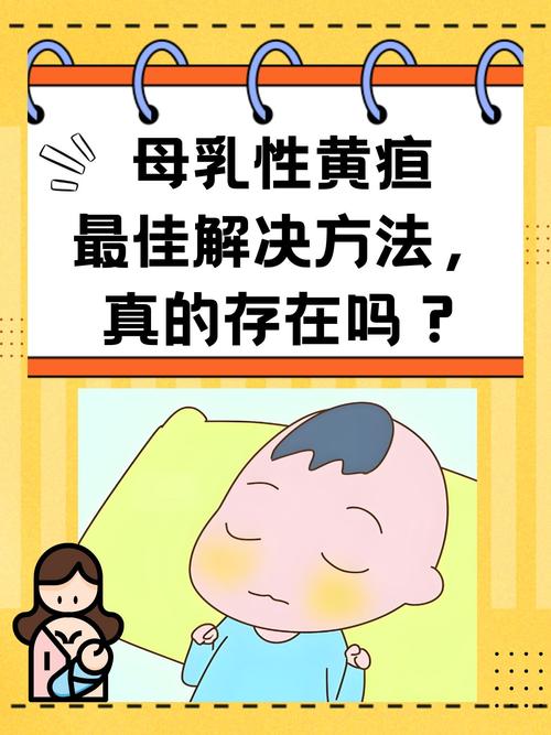 新生儿黄疸期间能否继续母乳喂养？需停母乳还是调整喂养方式？-第1张图片-郑州医学网