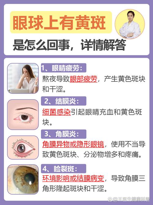 新生儿眼球发黄是黄疸吗？需要警惕哪些潜在问题？-第1张图片-郑州医学网