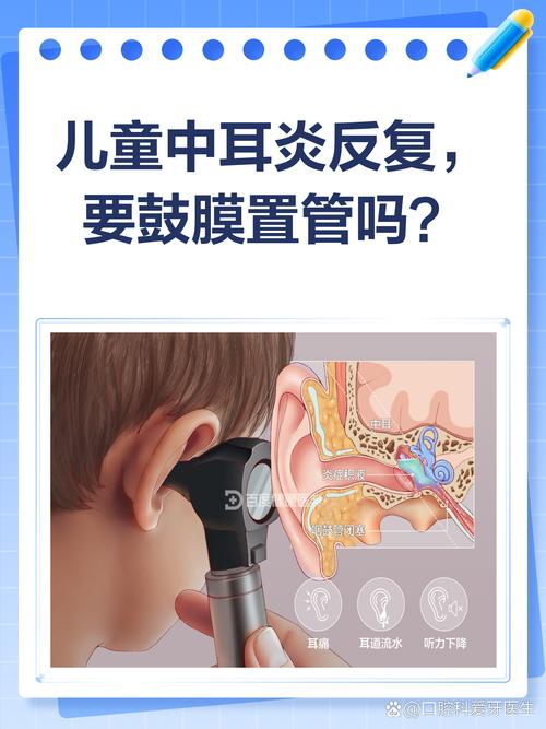 儿童鼓膜置管手术图解，全过程是怎样的？术后护理要注意什么？-第1张图片-郑州医学网