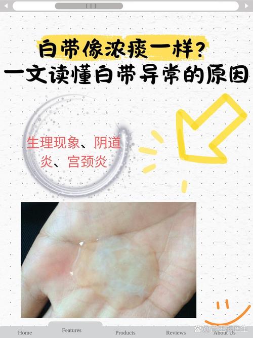 孕期白带突然变少是正常现象吗？会对胎儿有影响吗？-第3张图片-郑州医学网