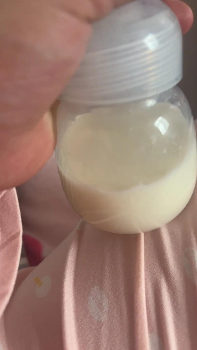 非孕期乳房挤出白色奶水是怀孕信号还是疾病预警？-第2张图片-郑州医学网