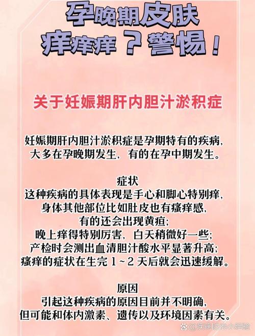 孕期胆汁淤积症图片长啥样？皮肤瘙痒、黄疸症状如何通过图片识别？-第2张图片-郑州医学网