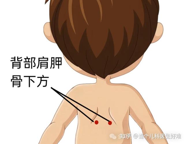 儿童感冒贴该贴哪些穴位？附正确位置图及注意事项-第1张图片-郑州医学网