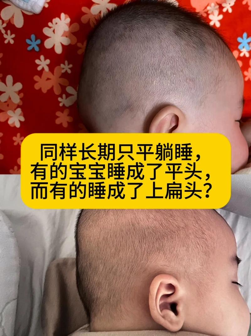 新生儿平躺侧躺各有何风险？哪种睡姿更利于健康发育？-第1张图片-郑州医学网