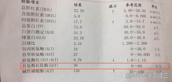 新生儿谷氨酰转肽酶偏高，究竟是什么原因导致的呢？-第3张图片-郑州医学网