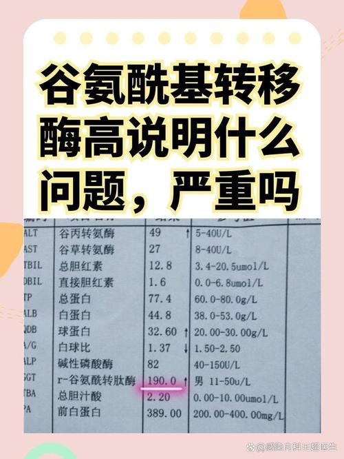 新生儿谷氨酰转肽酶偏高，究竟是什么原因导致的呢？-第2张图片-郑州医学网