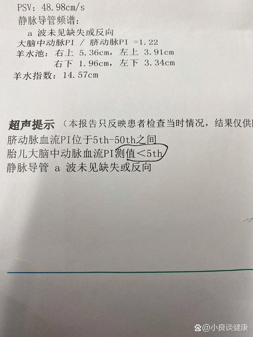 新生儿大脑中动脉RI值偏高或偏低意味着什么？-第3张图片-郑州医学网