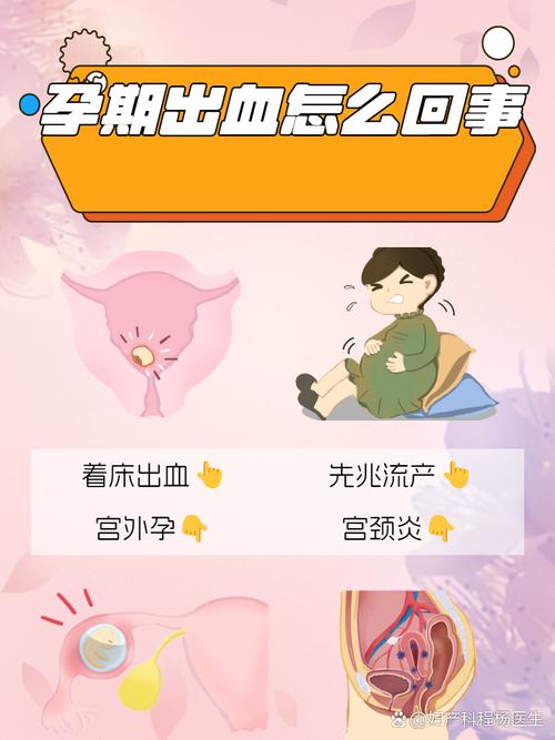 孕期无痛出血是正常生理现象还是危险信号？需警惕哪些潜在原因？-第1张图片-郑州医学网