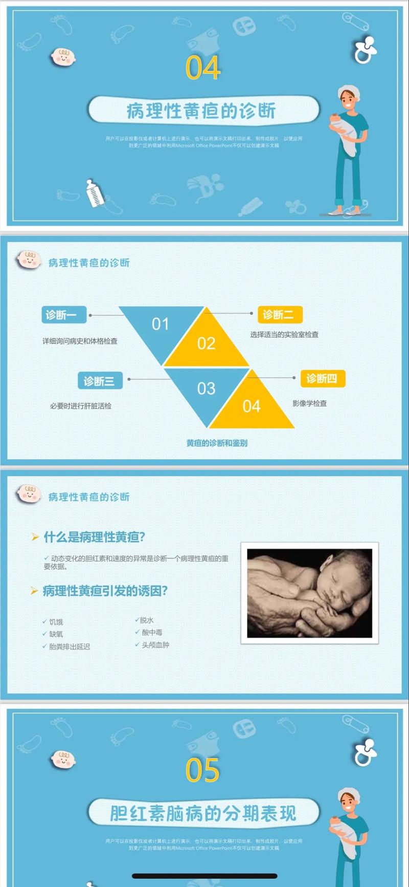 新生儿黄疸护理PPT，新手爸妈如何科学应对与家庭护理要点？-第1张图片-郑州医学网