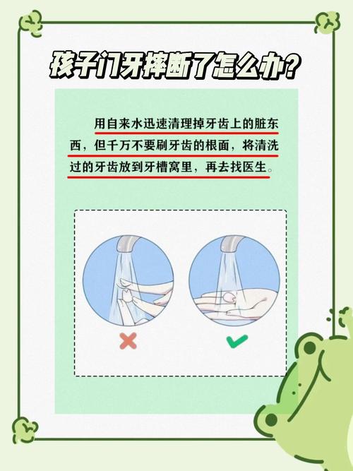 儿童不慎断牙怎么办？紧急处理与后续修复全攻略！-第3张图片-郑州医学网