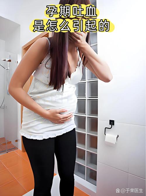 孕期胃酸吐血是紧急信号吗？需警惕哪些危险因素及应对措施？-第3张图片-郑州医学网