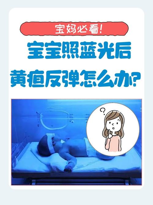 新生儿照蓝光治疗存在哪些潜在风险与副作用？-第3张图片-郑州医学网