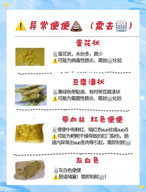 新生儿几天不大便是否正常？需要警惕哪些异常情况？-第1张图片-郑州医学网