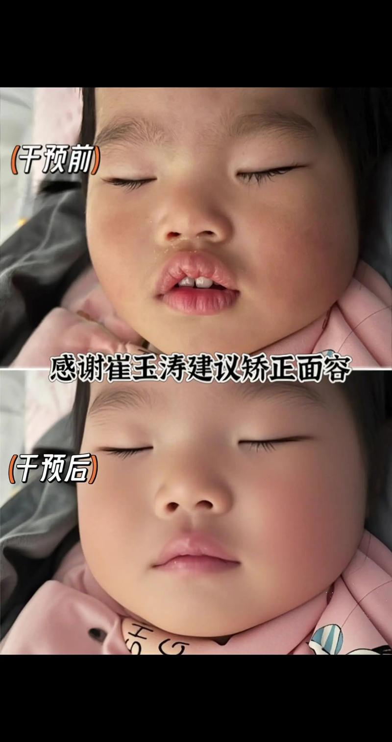 新生儿睡觉总张着嘴是正常现象还是潜在健康信号？-第2张图片-郑州医学网