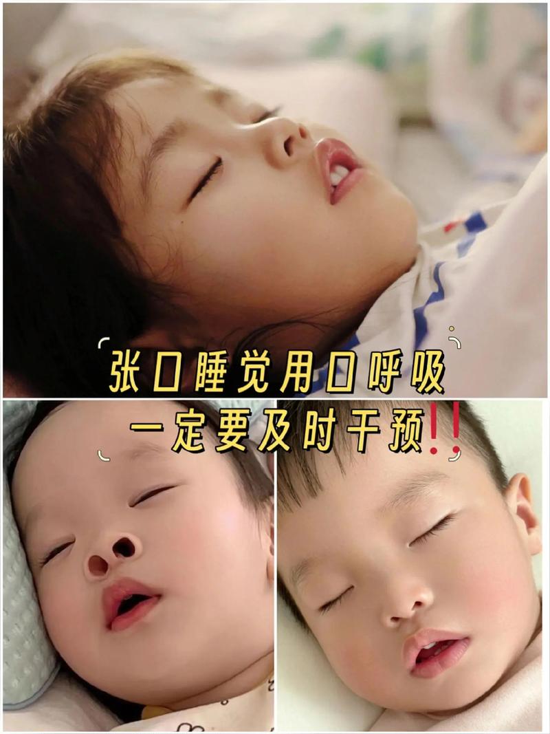 新生儿睡觉总张着嘴是正常现象还是潜在健康信号？-第1张图片-郑州医学网
