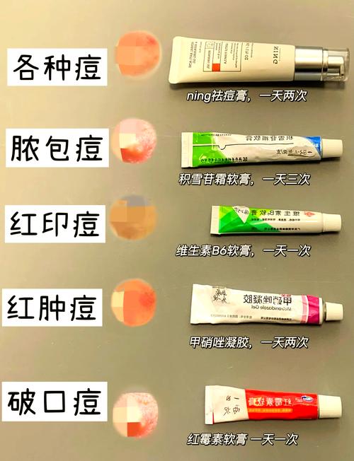 孕期长痤疮到底用什么治疗才安全有效？-第1张图片-郑州医学网