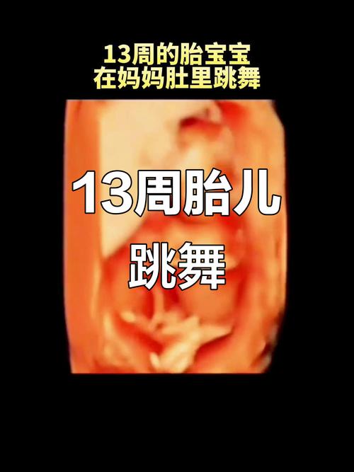 孕期13周胎儿会动吗?这时候的胎动感觉是怎样的?-第1张图片-郑州医学网 孕期13周胎儿会动吗?这时候的胎动感觉是怎样的?-第1张图片-郑州医学网