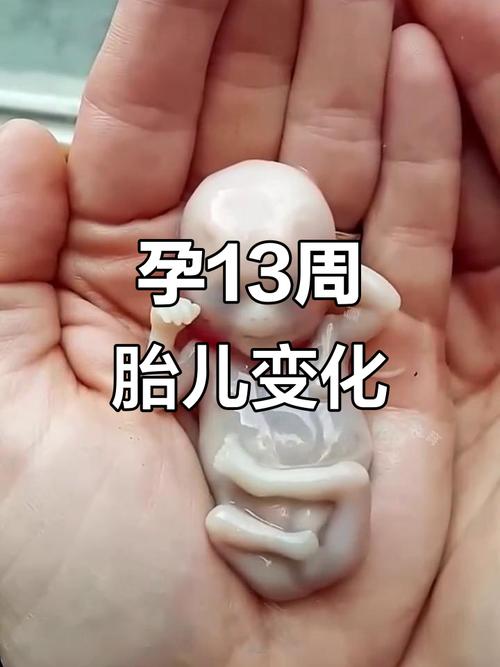 孕期13周胎儿会动吗?这时候的胎动感觉是怎样的?-第2张图片-郑州医学网 孕期13周胎儿会动吗?这时候的胎动感觉是怎样的?-第2张图片-郑州医学网