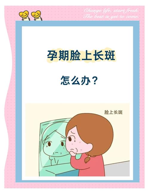 孕期脸上长斑怎么办?5个科学预防方法让你孕期肌肤依然白皙!-第1张图片-郑州医学网 孕期脸上长斑怎么办?5个科学预防方法让你孕期肌肤依然白皙!-第1张图片-郑州医学网