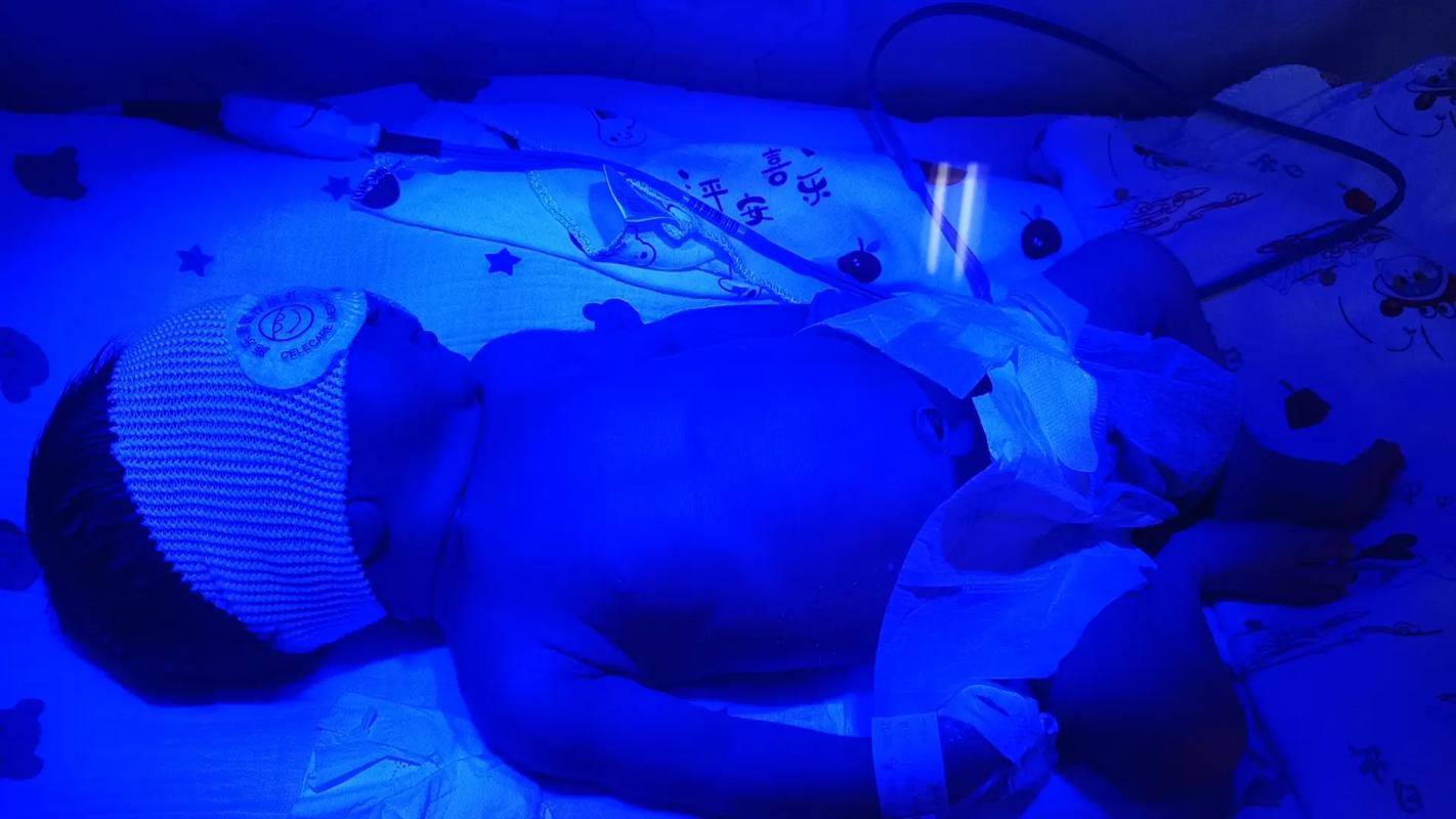 新生儿照蓝光会有哪些潜在影响？家长需要了解哪些注意事项？-第3张图片-郑州医学网