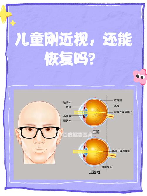 儿童近视一旦发生真的能恢复正常视力吗？-第1张图片-郑州医学网