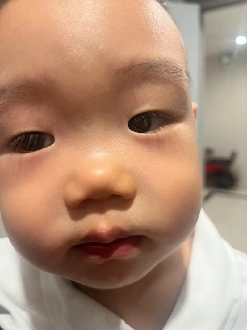 儿童鼻梁长高有黄金期？哪些因素会影响发育速度？-第1张图片-郑州医学网