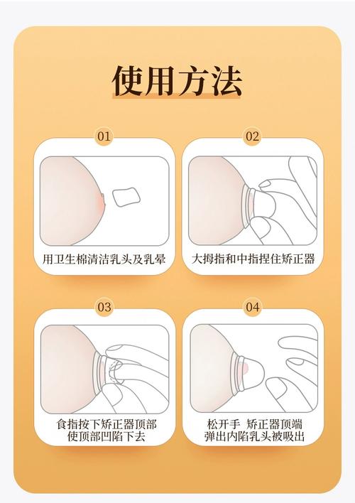 孕期矫正乳头内陷可行吗？对哺乳有影响吗？最佳方法和注意事项有哪些？-第1张图片-郑州医学网