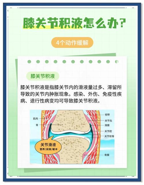 儿童膝盖积液怎么治疗？需要手术吗？日常护理要注意什么？-第2张图片-郑州医学网