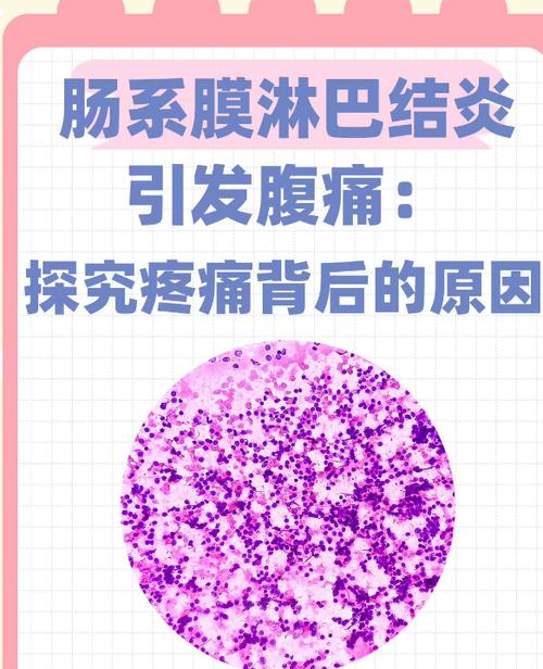 儿童肠系膜淋巴结偏大到底要不要紧？需要治疗吗？-第2张图片-郑州医学网