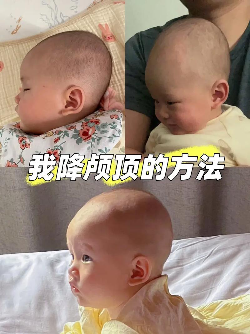 新生儿头长偏大怎么办？会影响发育吗？需要干预吗？-第2张图片-郑州医学网