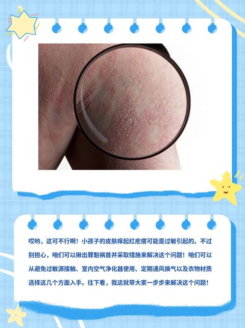 新生儿外阴很红是正常现象吗？需要怎么处理才不会感染？-第3张图片-郑州医学网