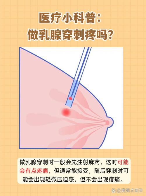 孕期乳腺穿刺到底能不能做？对胎儿有影响吗？-第1张图片-郑州医学网