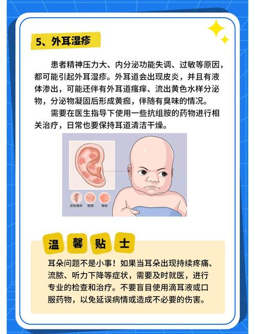 新生儿外耳道湿疹反复发作，究竟是什么原因在作祟？-第1张图片-郑州医学网