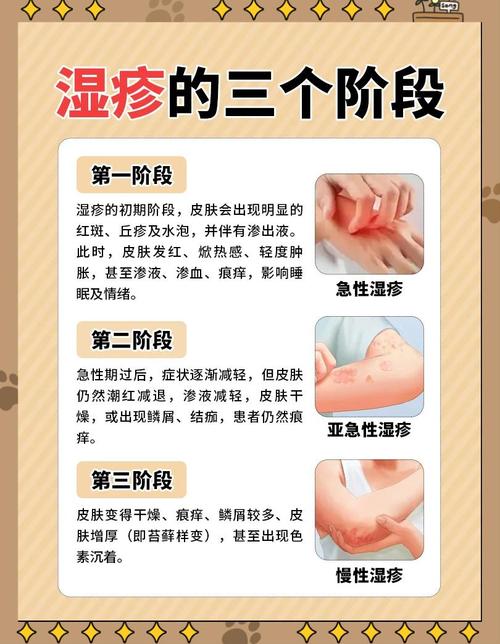 孕期湿疹饮食怎么吃才不加重？这5类食物要避开吗？-第2张图片-郑州医学网