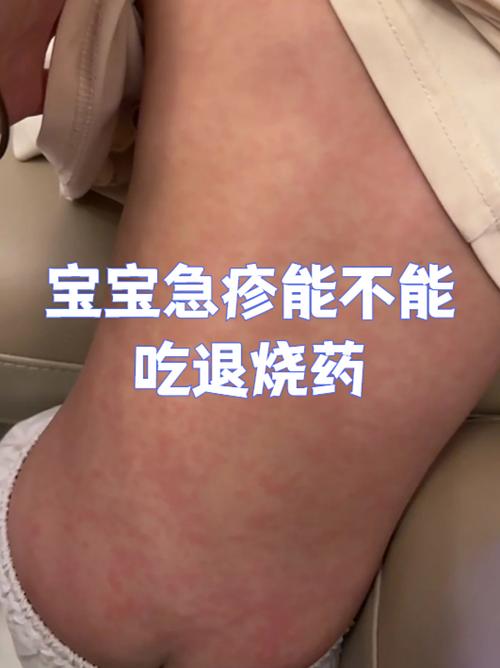 新生儿身体发烫但体温正常，是哪些生理原因导致的呢？-第1张图片-郑州医学网