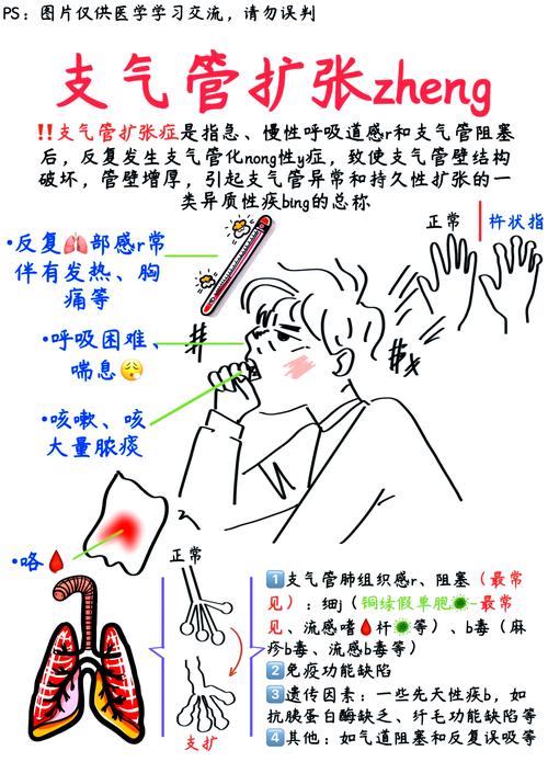 儿童支气管扩张有哪些典型症状？家长该如何早期识别与应对？-第3张图片-郑州医学网