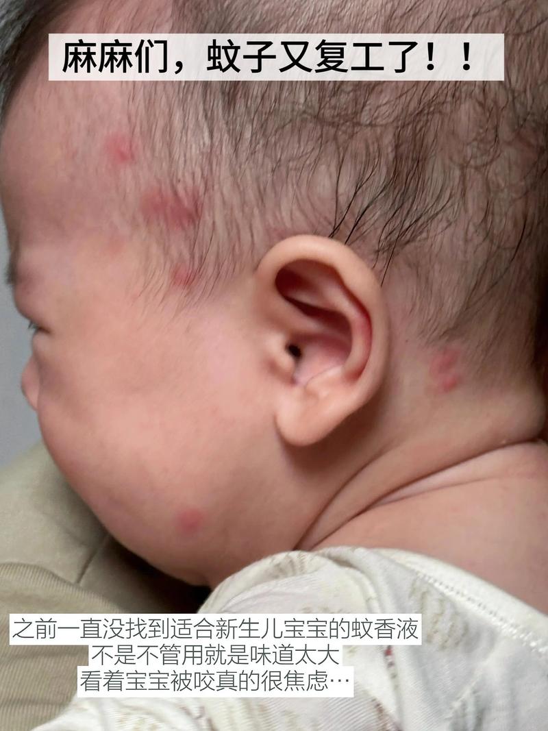 新生儿使用蚊香真的安全吗？会对呼吸系统造成潜在影响吗？-第3张图片-郑州医学网