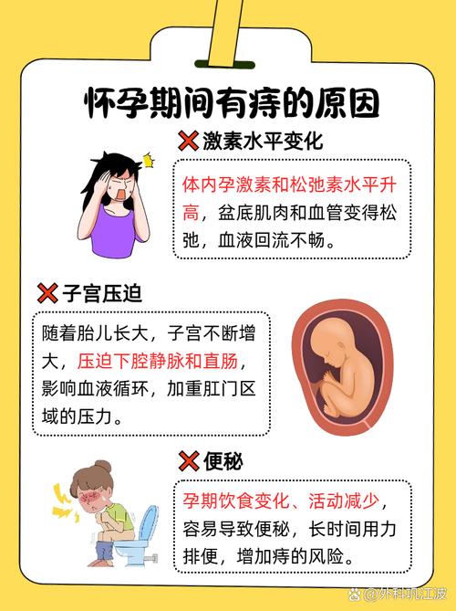 孕期外痔疮是什么原因造成的？对孕妇和胎儿有影响吗？-第1张图片-郑州医学网