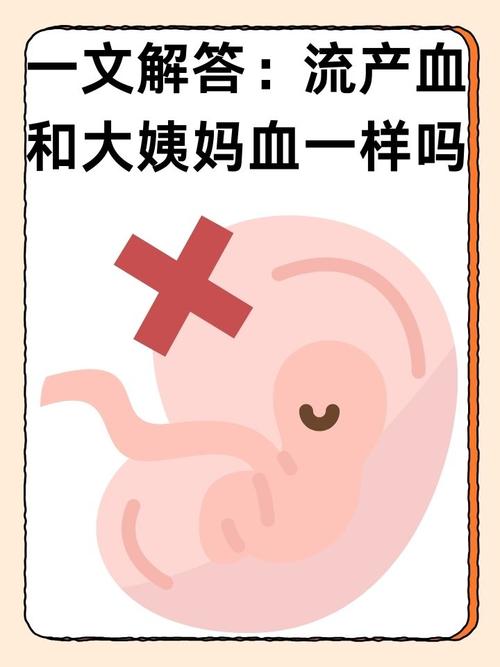 孕期出血和月经到底有何不同？如何区分异常出血与正常月经？-第3张图片-郑州医学网